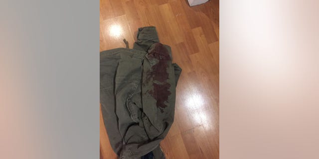 The bloodied jacket worn by Mark Kindschuh, 19, a Boston College student who helped save a man's life during the London terrorist attack.