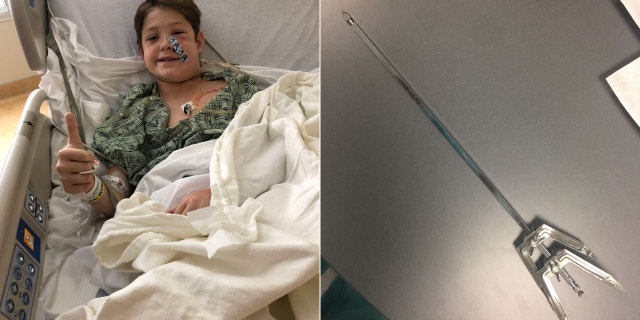 Xavier Cunningham at the hospital after he had the meat skewer removed from his face.