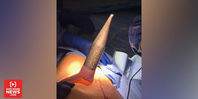 Surgeons worked for four hours to safely remove the spear.
