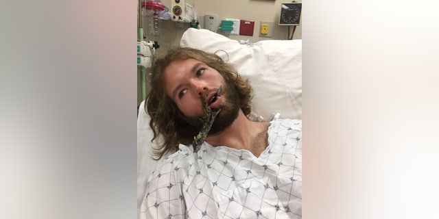 impaled skier 1