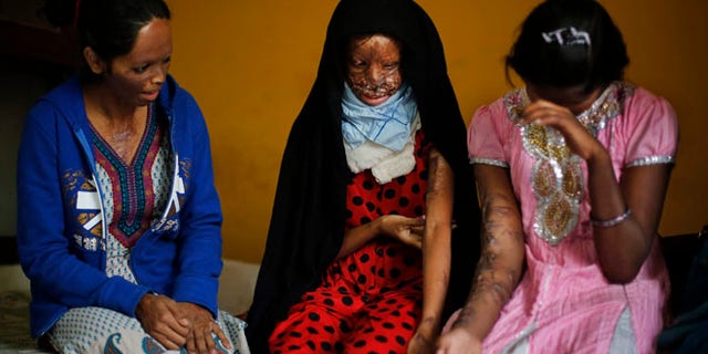 Dec. 5, 2013: In this photo, acid attack victims, from left, Laxmi, 24, Chanchal, 19, and Sonam, 16, interact in the office of the Indian NGO Stop Acid Attacks, in New Delhi, India. Victims of acid attacks are pressing the Indian government to do more to prevent such violence, saying a new law aimed at restricting the sale of dangerous is being ignored. Highly concentrated acids are readily available in India for use as household and industrial cleaners.