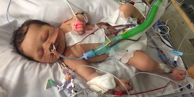 "Nothing can make you surrender more than having to give your child to a surgeon when there’s a chance of death. I have never cried so much," said mother Aimee Roberts.