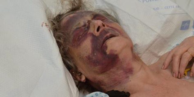 Iris Warner, a 90-year-old woman in the UK, was brutally assaulted in her sleep. Police are searching for her attacker.