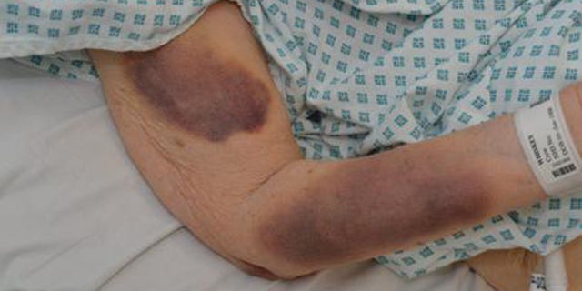 Iris Warner, a 90-year-old woman in the UK, was brutally assaulted in her sleep. Police are searching for her attacker.
