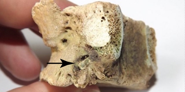 The remains of an Iron Age warrior, who survived in spite of a bronze arrowhead (see pointer) embedded in his vertebra.