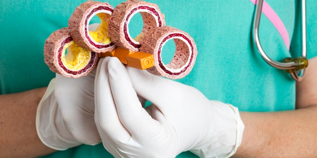 Have you heard about lipoprotein(a), or Lp(a)?
