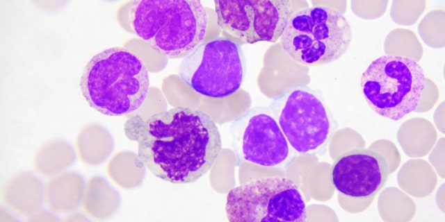 The pathogen has also been dubbed a cousin of HIV because of the similarities in the way it’s spread.