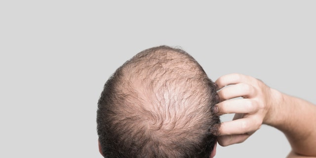 Bald young man, rear view, gray background