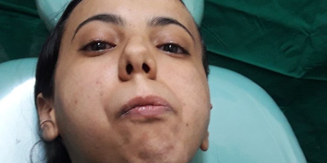 Fatima told SWNS she was so grateful after the surgery, “I can not wait to go back home and scream my lungs out and tell the world that I can now lead a normal life."