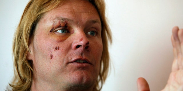 May 22, 2014: Western Kentucky University professor John All speaks during an interview with The Associated Press in Katmandu, Nepal. The American climber said he fell into a crevasse on a mountain in Nepal but managed to crawl to his tent despite broken ribs and an arm before being rescued the next morning.