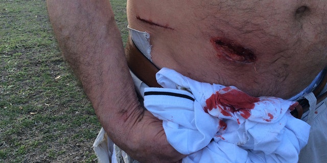 The attacks have been reported after people try to feed the animals junk food.