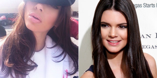 Kendall Jenner showed off suspiciously fuller lips.