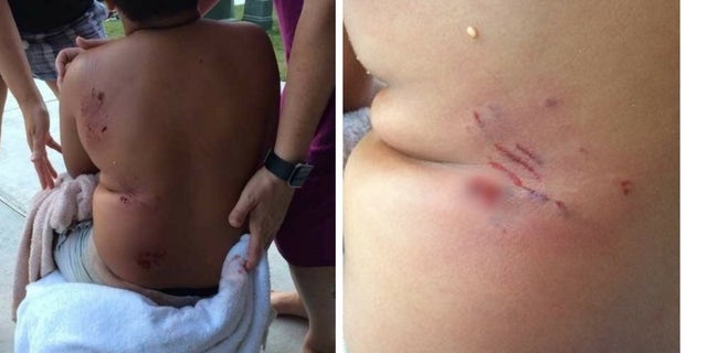A seven-year-old boy was attacked by a dog in a Manor, Texas, on Monday, July 3, 2017.