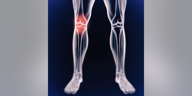 A cgi view of an inflamed joint isolated on blue