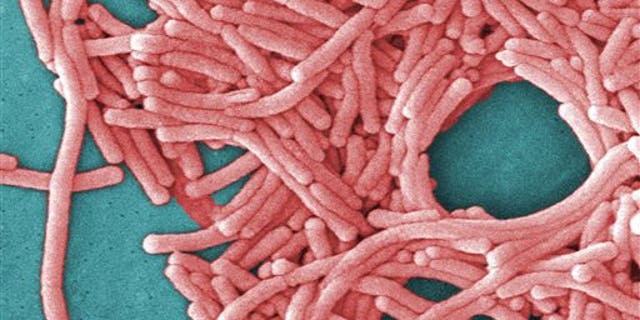 This undated image made available by the Centers for Disease Control and Prevention shows a large grouping of Legionella pneumophila bacteria (Legionnaires' disease). (Janice Haney Carr/Centers for Disease Control and Prevention via AP) .