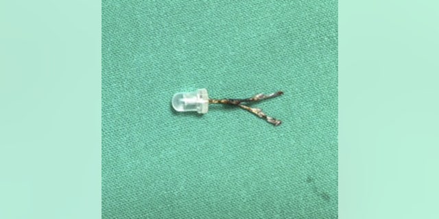 Dr. Divya Prabhat, head of the ENT department at Wadia Hospital in Mumbia said, "To our surpise this happened to be a 2 cm LED bulb, which I have not seen before, despite performing thousands of bronchoscopies."