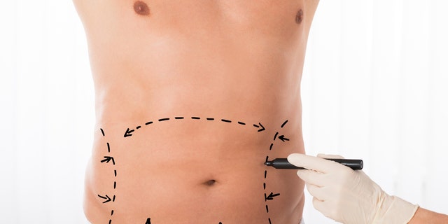Close-up Of Person Hands Drawing Correction Lines On Stomach