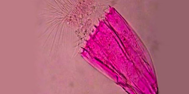 This newfound creature, a loriciferan found more than 10,000 feet deep off the southern coast of Greece, lives completely without oxygen. This specimen is stained red.