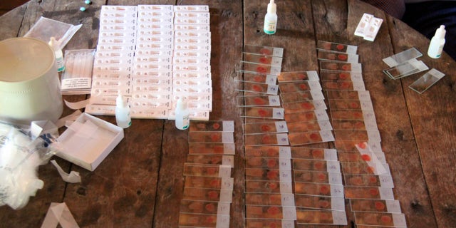 Malaria tests are seen on a table in the Ta Gay Laung village hall in Hpa-An district in Kayin state, south-eastern Myanmar, November 28, 2014. REUTERS/Astrid Zweynert