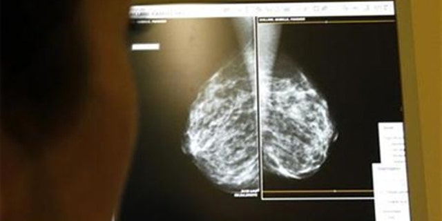 Peran estrogen dalam kanker payudara – dan cara mengurangi risiko penyakit Anda