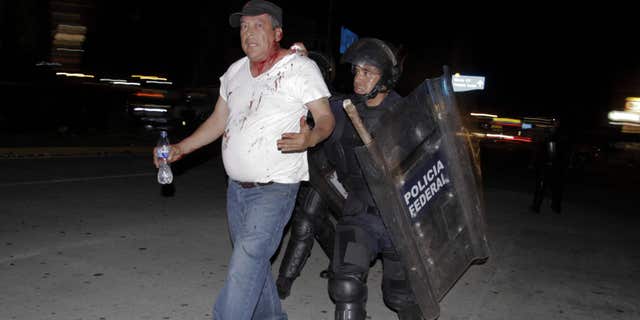 Feb. 24, 2015: An injured protester is taken into custody by police during a protest demanding better labor conditions for teachers in Acapulco, Mexico.
