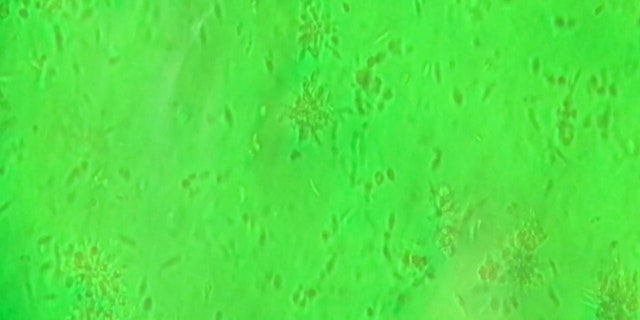 The parasite which causes Cutaneous Leishmaniasis as seen through a microscope.