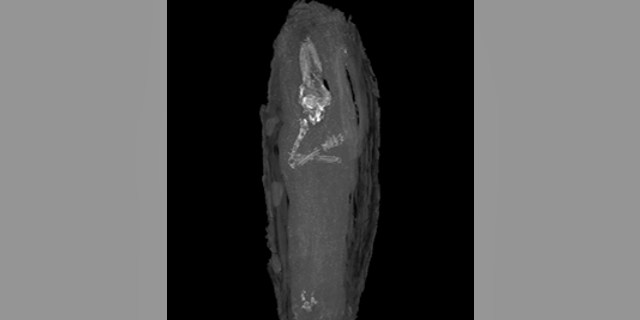 Micro CT scan image of the upper limbs and skull of fetus. (The Fitzwilliam Museum, Cambridge)