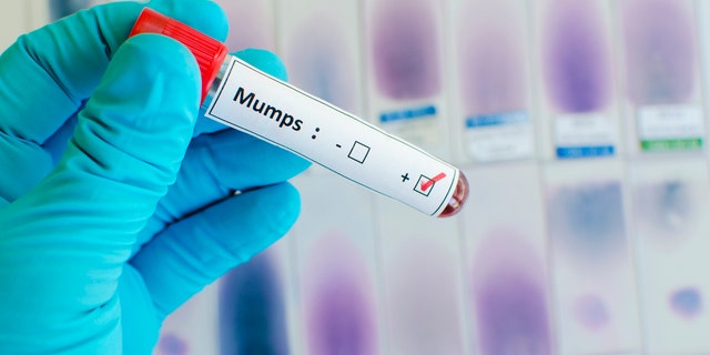 A statement said the school’s health providers are working with state officials to manage and test students with potential symptoms of the disease.