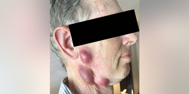 The man mentioned that he had been administering medication to his sick cat before it died.