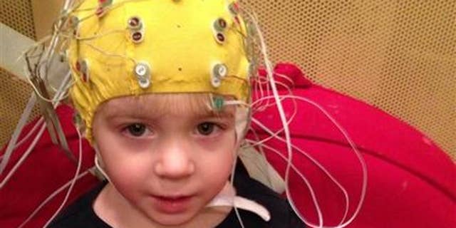 This undated handout photo provided by the Auditory Neuroscience Lab, Northwestern University, shows scalp electrodes to pick up how children's brains react to sounds such as speech in a noisy background.