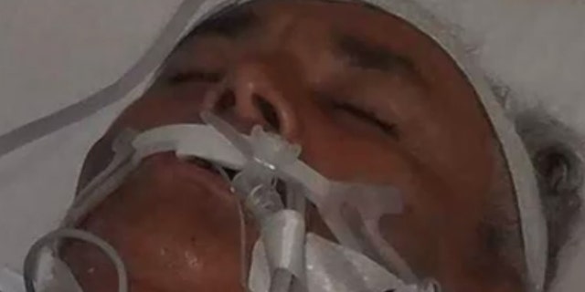 Angel Perez, 60, complained of symptoms after returning from crabbing on July 2.