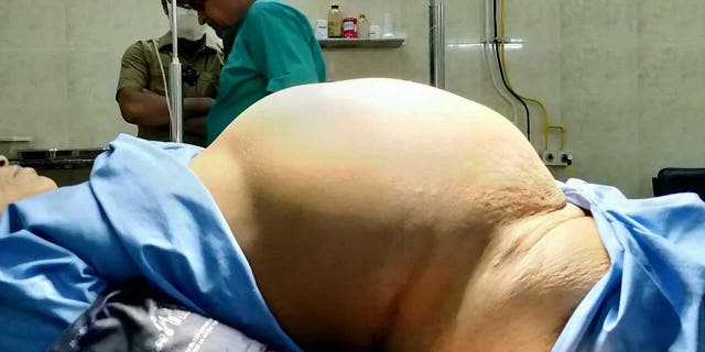 The tumor grew in size to be 14 x 16 inches, to the point where the patient was admitted to the hospital in excruciating pain.
