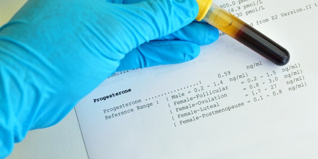Blood sample with progesterone testing result