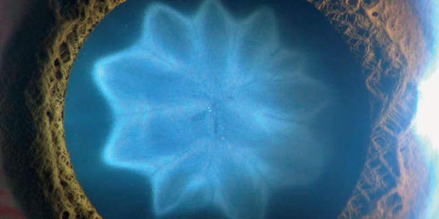 A man in India developed an unusual, flower-shaped cataract after a bike accident.