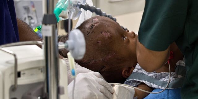 Doctors prepare 1-year old Roona Begum, suffering from hydrocephalus, a buildup of fluid inside the skull that leads to swelling, for surgery at a hospital in Gurgaon, on the outskirts of New Delhi, on June 27, 2013. The girld endured several surgical procedures which saw doctors drain fluid from her head in a life-saving operation and dramatically reduce the size of her skull.