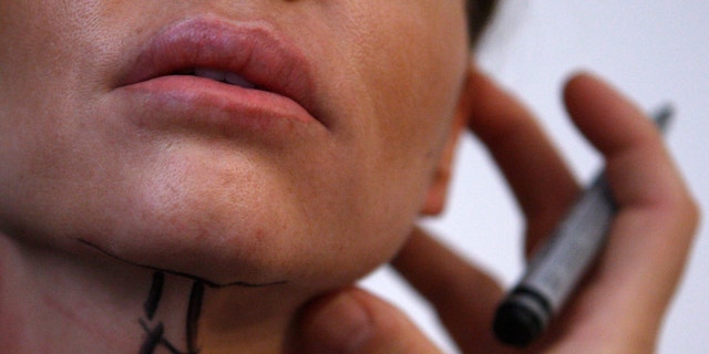 A patient prepared for a facelift surgery is seen at a private plastic surgery clinic in Budapest, March 1, 2012.