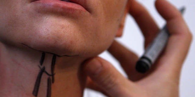 A patient prepared for a facelift surgery is seen at a private plastic surgery clinic in Budapest, March 1, 2012.