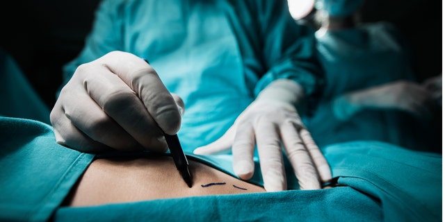 De staat Florida heeft chirurgen beperkt tot het uitvoeren van maximaal drie BBL's per dag.  Longvetembolie is de belangrijkste doodsoorzaak tijdens BBL-procedures, blijkt uit onderzoeken.