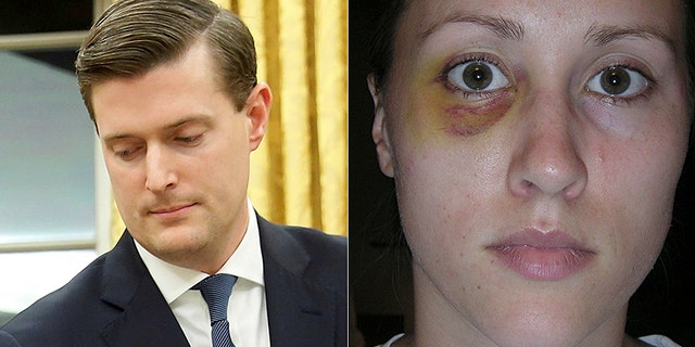 Photos have emerged showing Rob Porter's ex-wife Colbie Holderness with a black eye.