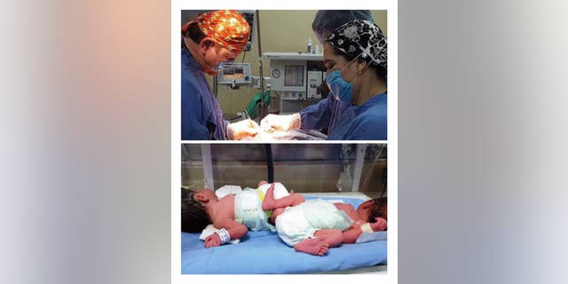 A combo of photographs provided by the Mexican Social Security Institute (IMSS) shows the twins born prematurely to a 58-year-old woman in the state of Sinaloa, Mexico.