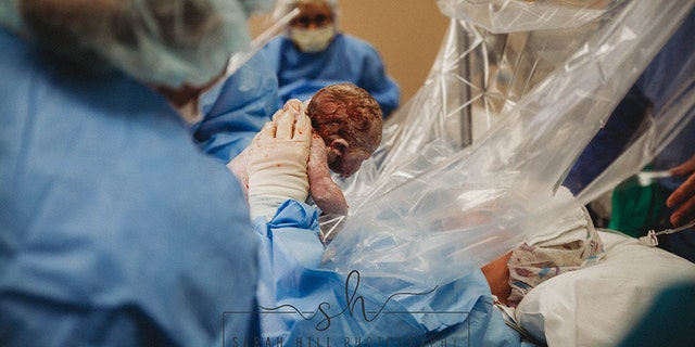 The day of the surgery, Emily Dial was given gloves to wear and a clear sterile screen to protect her face while allowing her to watch everything.