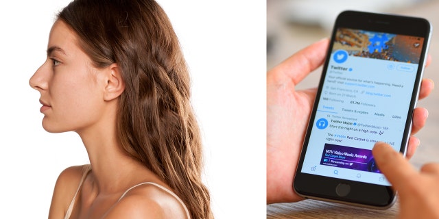 A body-positive campaign asking women to embrace their big noses by posting a profile selfie has gone viral on Twitter.
