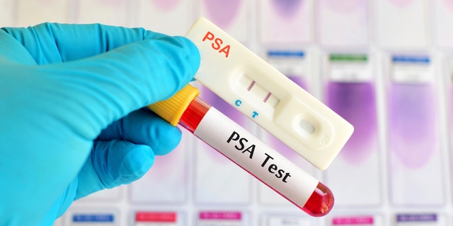Tes PSA (diagnosis kanker prostat) dengan menggunakan kaset tes, hasilnya positif (garis merah ganda)