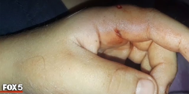 The boy was rushed to the hospital and has already received his first rabies shot.