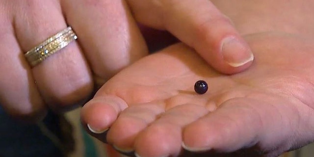 In this undated image taken from video provided by KOMOnews.com, Lindsay Hasz holds a rare pearl that she found in her seafood meal while dining at an Italian restaurant in Issaquah, Wash. Hasz said she took it to a gemologist, who determined it was a Quahog purple pearl worth about $600. (KOMOnews.com via AP) SEATTLE OUT; NO SALES