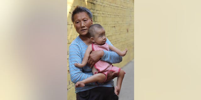 Pic shows: The boy Wang Sanjin and his grandmother Zhou Xuelian;
The grandmother of a boy born with his limbs facing the wrong way is hoping the public will help fund surgery that would give him a chance at a normal life.
The one-year-old boy named Wang Sanjin was abandoned by his own parents at birth because of the defects which have left his hands and legs reversed at their elbow and knee joints.
The condition was considered so bad that Sanjinâs dad, from Zhumadian City in Central Chinaâs Henan Province, said he wanted nothing to do with the boy and that he would rather have another child.
But Sanjinâs grandmother Zhou Xuelian could not bear to simply cast the child out, so she brought him back to her own home and raised her with her husband.
In the 15 months since Sanjinâs birth, his dad has not visited once or provided any form of financial support, while his mum is as a migrant worker in another city.
Zhou and her husband, who are in their 60s and 70s, make a living by collecting and selling recyclable waste, and they are hoping to crowd-fund Sanjinâs treatment so he can potentially live a normal and independent life in the future.
Doctors have told Zhou that surgery to correct Sanjinâs bones would cost more than 300,000 RMB (34,642 GBP) â an amount she called "astronomical".
But with so many touching stories of crowdfunded medical miracles, the woman is hoping one can be performed on her grandson as well.
She was quoted as saying: "My husband and I are getting on now. Sanjinâs granddad is in his 70s and Iâm in my 60s. Who knows how long we can keep raising him for?"
"I hope some kind people will agree to help our boy, just so his condition can be cured and he can start taking care of himself, then we can rest easy."