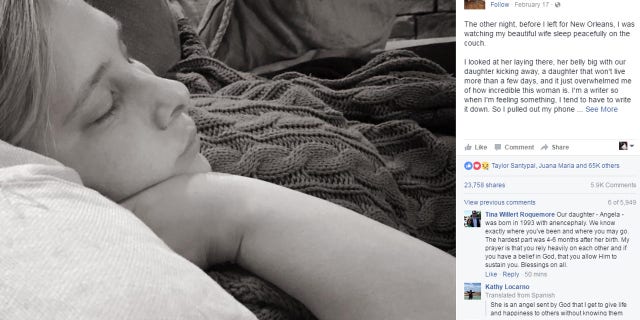 Royce and Kerri made the decision to carry their baby to term after learning that she did not have a brain so that they could donate her organs.