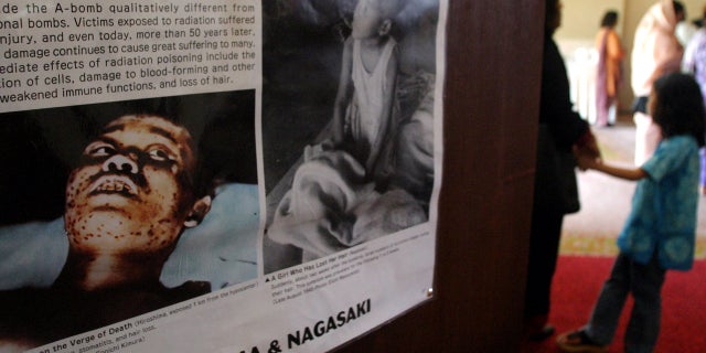 Photos show the effect of radiation from the atomic bombs dropped on Hiroshima and Nagasaki.
