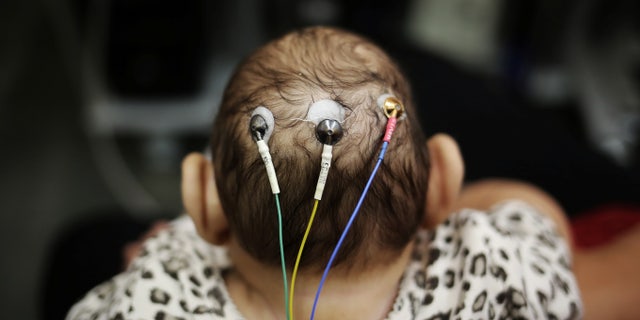 Five-month-old Laura undergoes a medical test at the University of Sao Paulo (USP) in Sao Paulo, Brazil April 28, 2016.