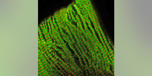 With cells illuminated by fluoresced antibodies, this microscopic photograph of sarcomeres— the part of heart muscle that generates tension and contraction— shows a mutant troponin protein used to study inherited cardiomyopathy.